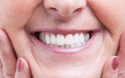 Dental Implants What to Expect